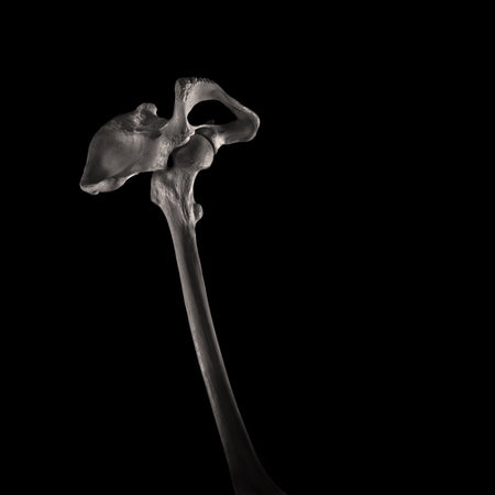 Art | Chan Dick | The Trek | Femur, Hip Bone and Hip Joint | Unframed | 24 x 26cm